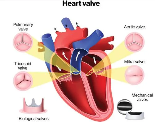 Heart Valve Rheumatic Heart Disease