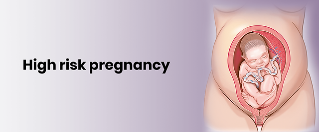 High Risk Pregnancies