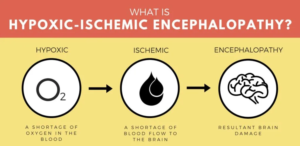 Hypoxic Ischemic Encphalopathy