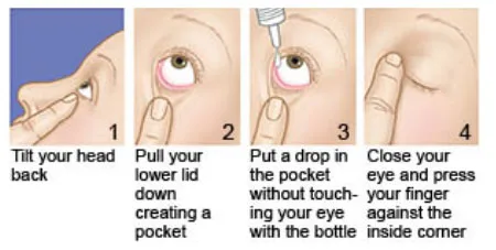 INSTILLATION OF EYE DROPS OINTMENT
