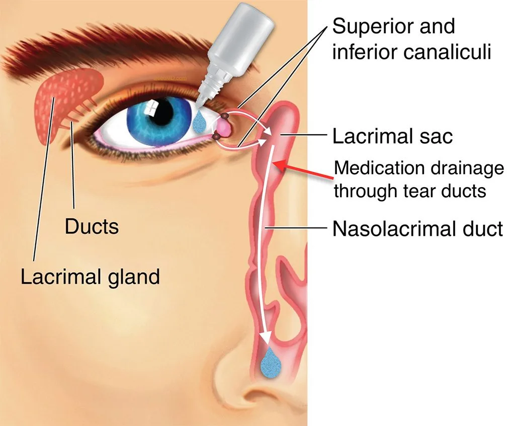 INSTILLING MEDICATION INTO THE EYES