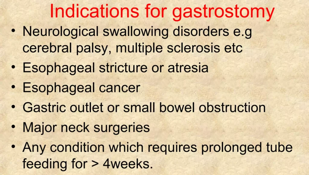 Indications Of Gastrostomy Feeding E1719484236790