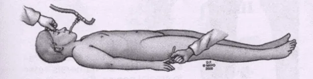 Introduction To Unconsciousness Coma 1
