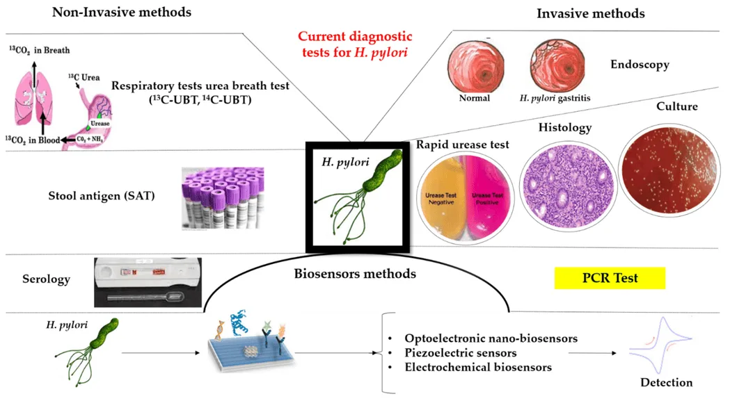 Investigations For Gastritis 1