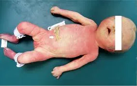 LAST OFFICE IN PERINATAL DEATH
