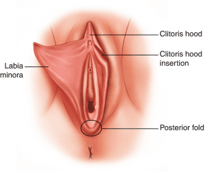 Labial Hypertrophy