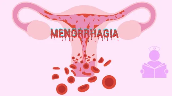 MENORRHAGIA