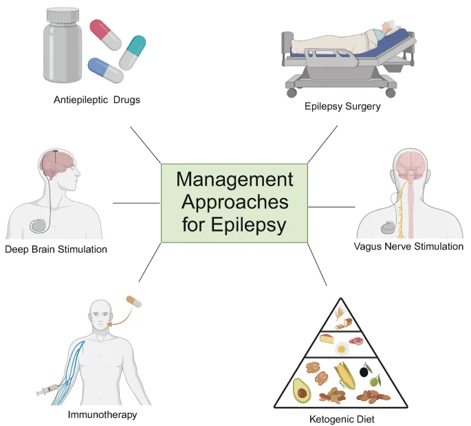 Management And Treatment Options For Epilepsy 1