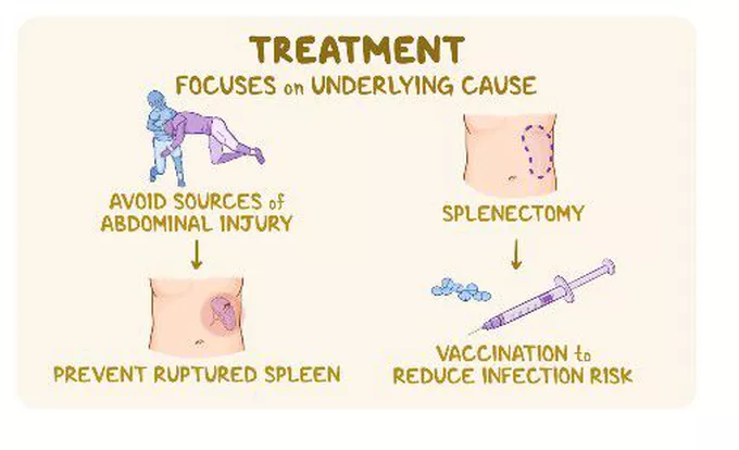 Management And Treatment Of Splenomegaly And Hypersplenism