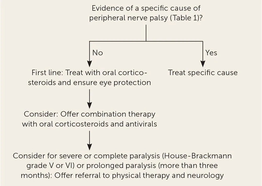 Management Of Bells Palsy 1 E1742449877339