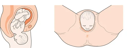 Normal Second Stage Of Labour