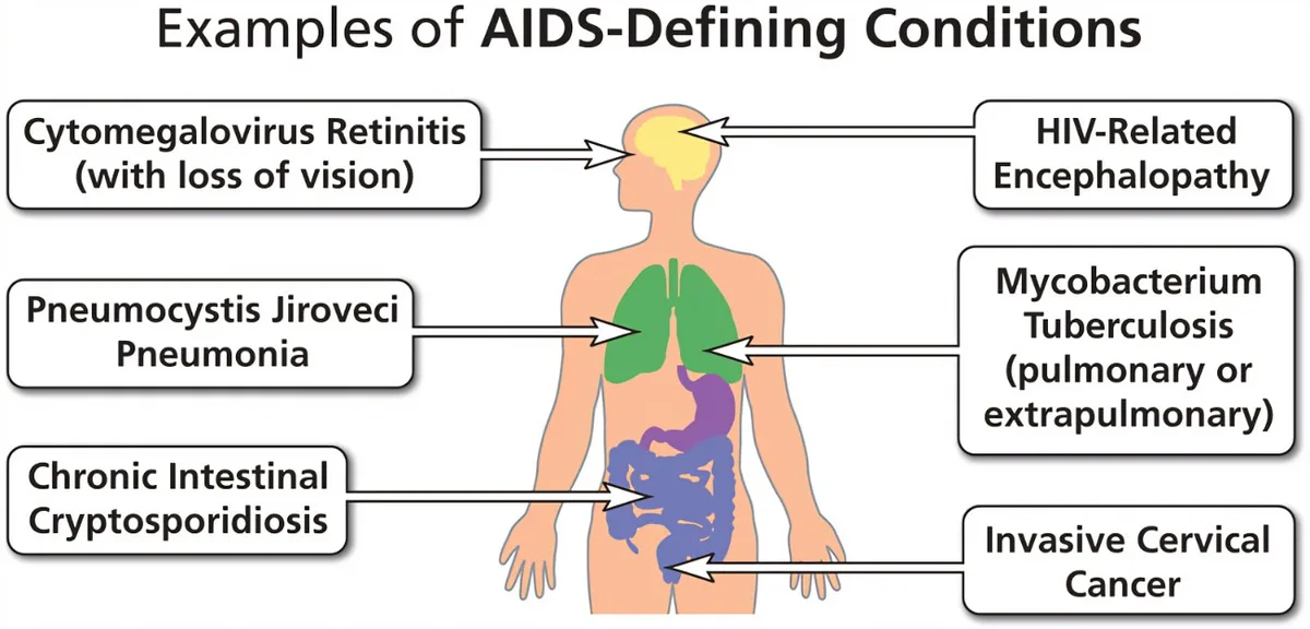 OPPORTUNISTIC INFECTIONS IN HIV AIDS