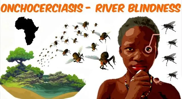 Onchocerciasis River Blindness E1736826293245