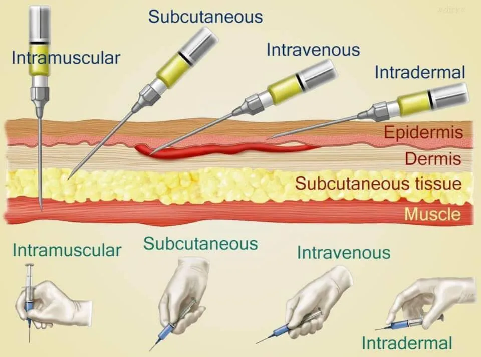 PARENTERAL ROUTE INJECTION