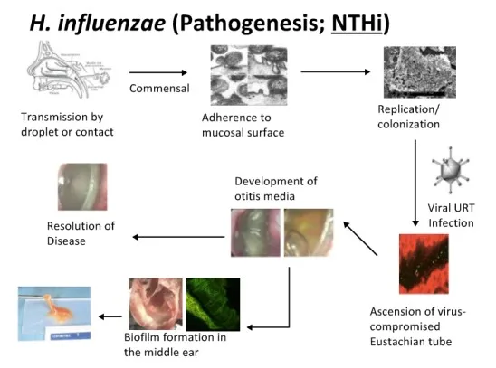 PATHOPHYSIOLOGY