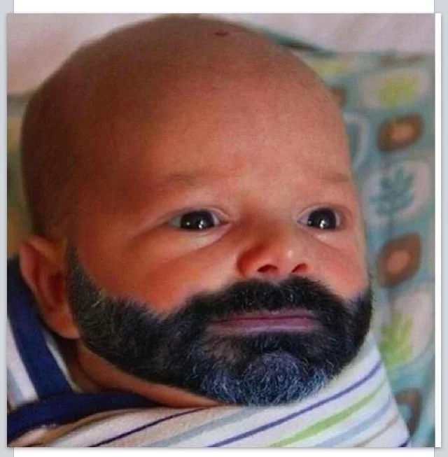 PRECOCIOUS PUBERTY