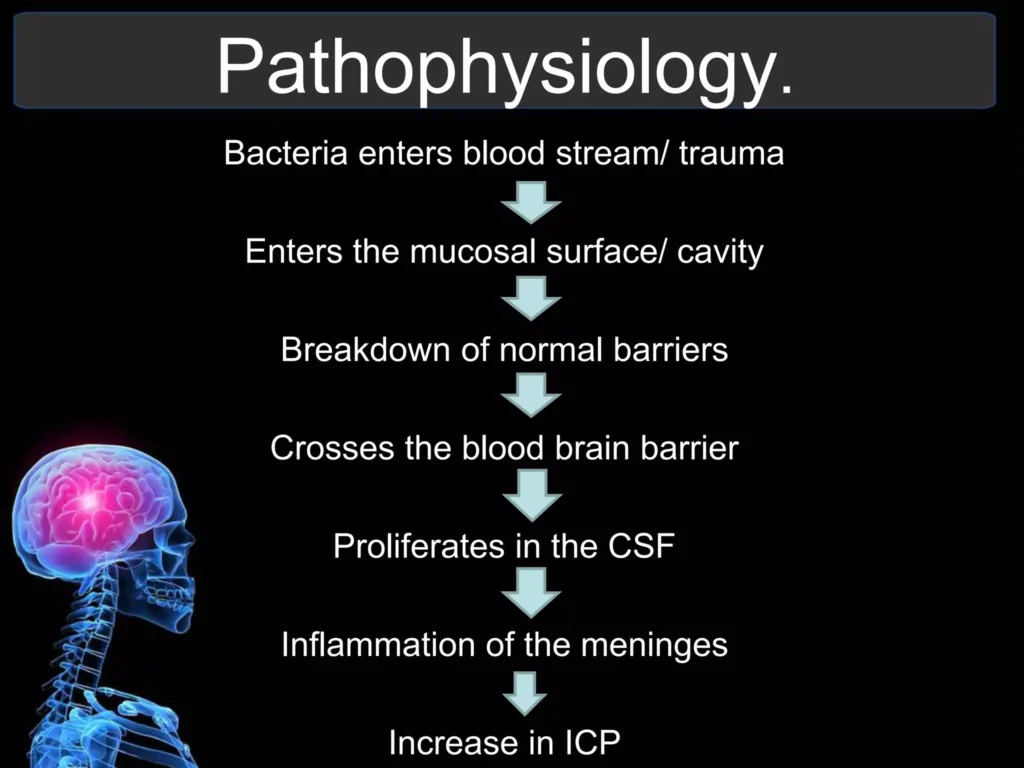 Pathophysiology Of Meningitis