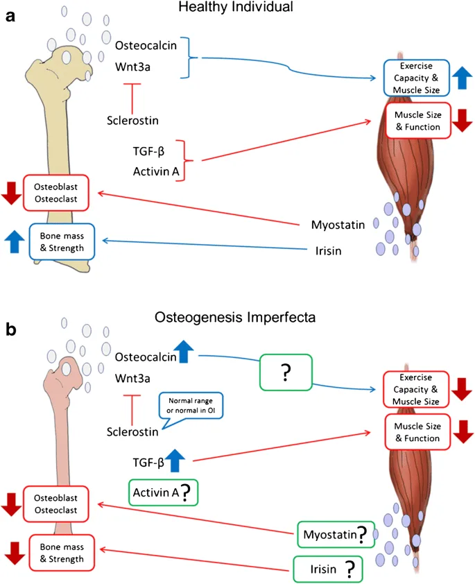 Pathophysiology Of Osteogenesis Imperfecta 1