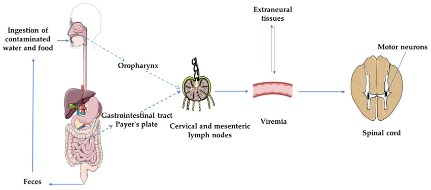 Pathophysiology Of Poliovirus Infection 1