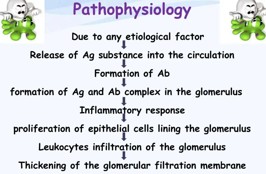 Pathophysiology Of Nephritic 1 E1703590024362