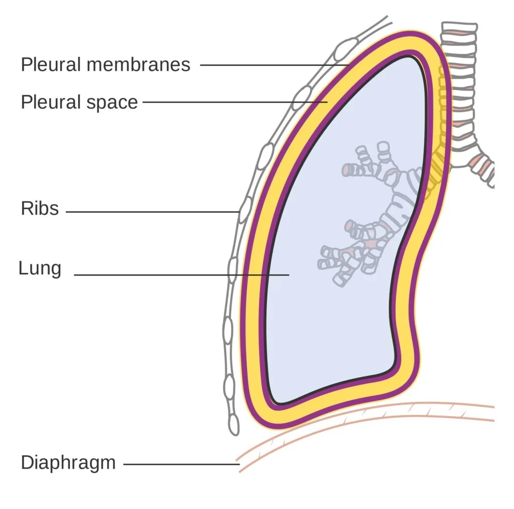 Pleural Space Underwater Seal Drainage 1
