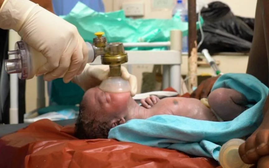 Resuscitation Of A Newborn