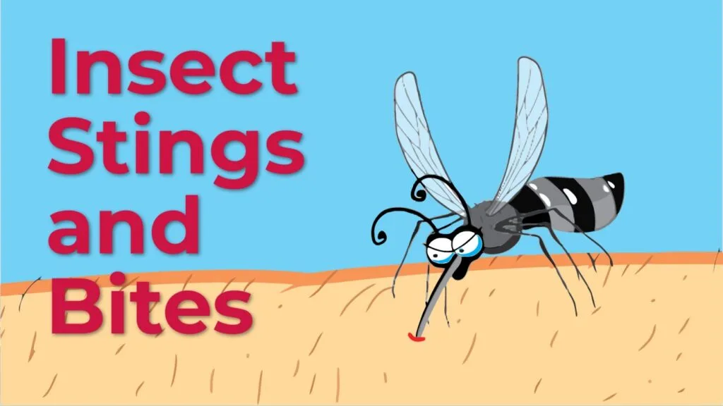 STINGS AND BITES