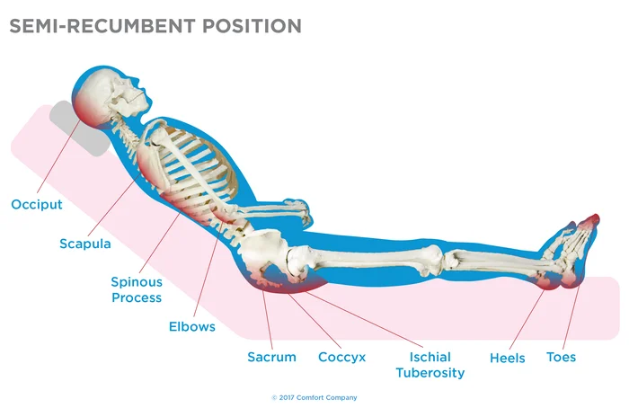 Semi Recumbent Position