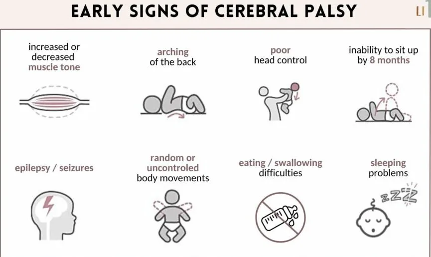 Signs And Symptoms Of Cerebral Palsy CP E1703153681866
