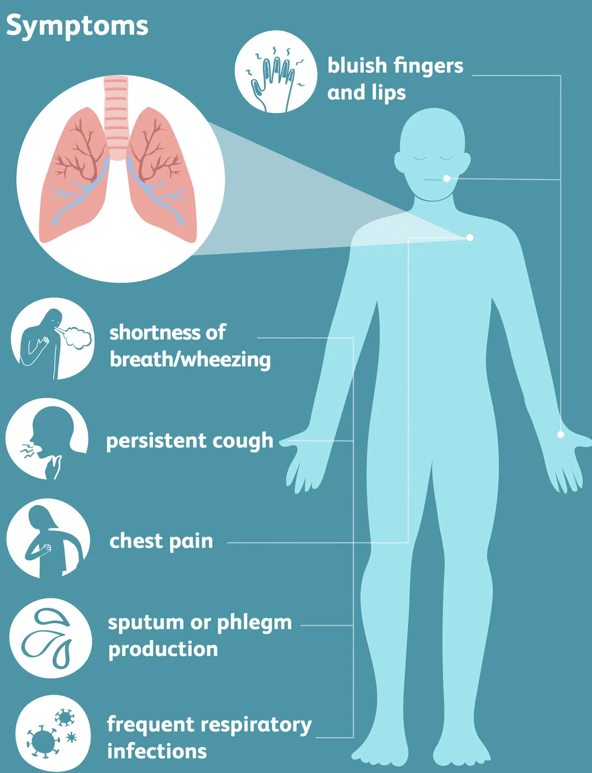 Signs And Symptoms Of Emphysema 2