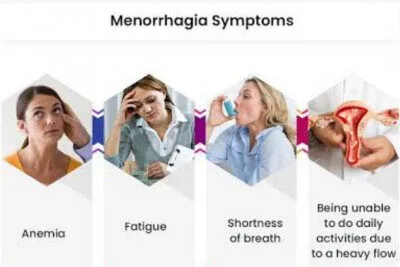 Signs And Symptoms Of Menorrhagia E1705240460716