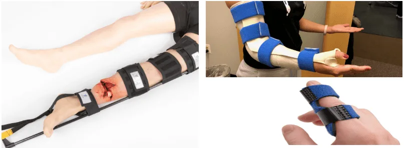 Splints 1