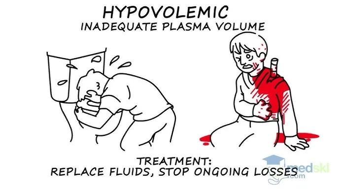 Surgical Shock