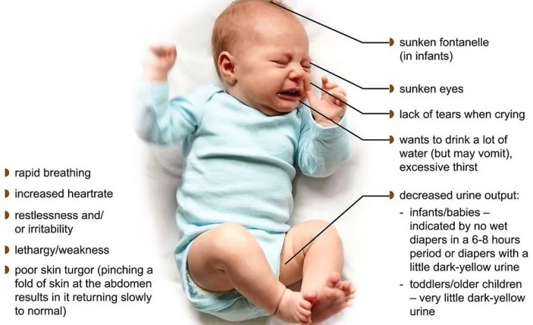 TREATMENT OF DEHYDRATION