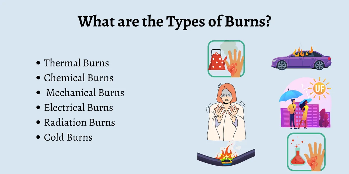 TYPES OF BURNS 2