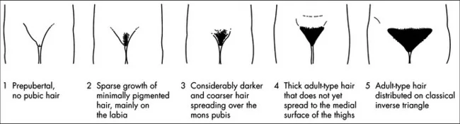 Tanner Stages In Females Pubic
