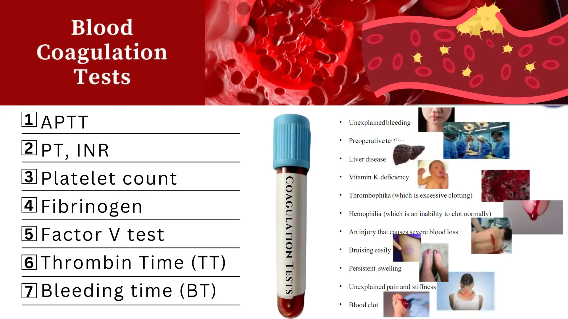 Test And Diagnosis For Coagulation Disorders