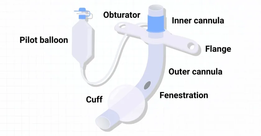 Tracheostomy Tubes