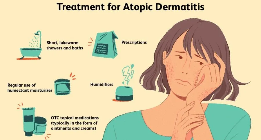 Treatment Of Atopic Dermatitis 1 E1707835897781
