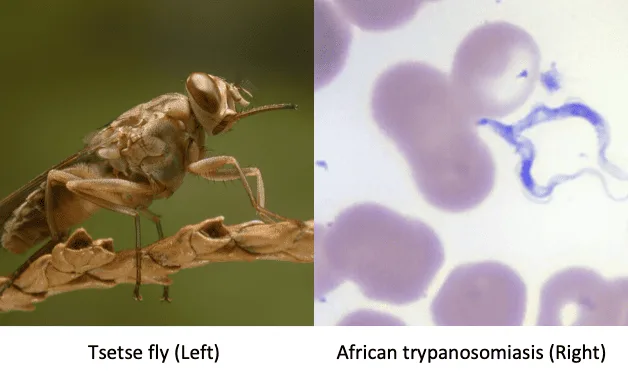 Trypanosomiasis Sleeping Sickness 1