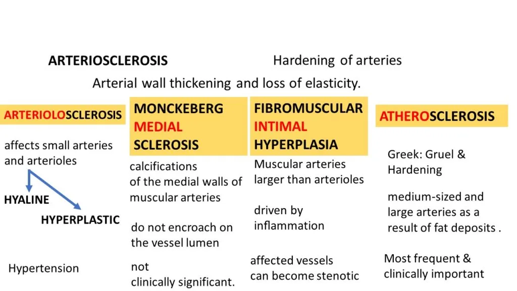 Types Of Arteriosclerosis