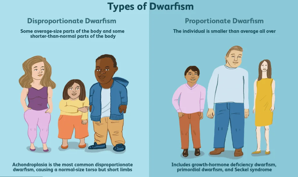 Types Of Dwarfism 1 E1742892654769