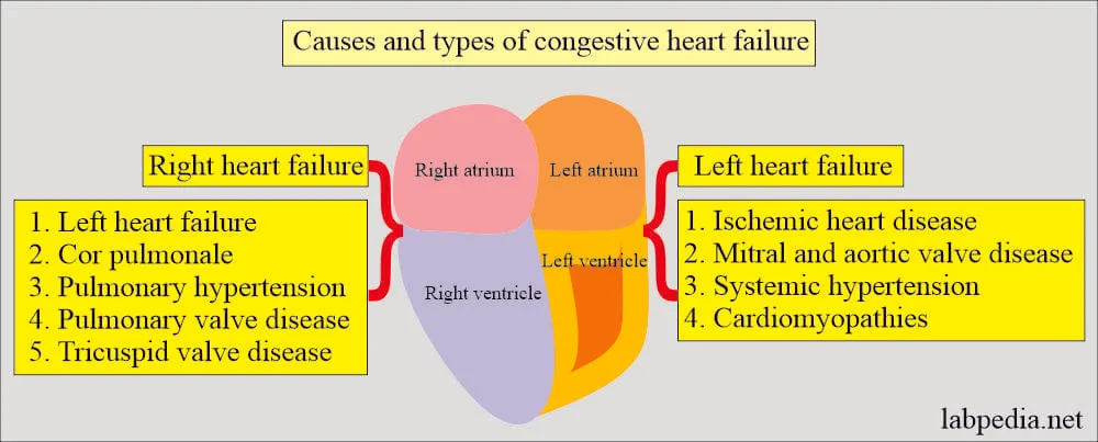 Types Of Heart Failure 1