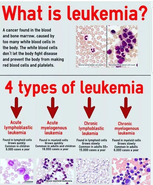Types Of Leukemia 2