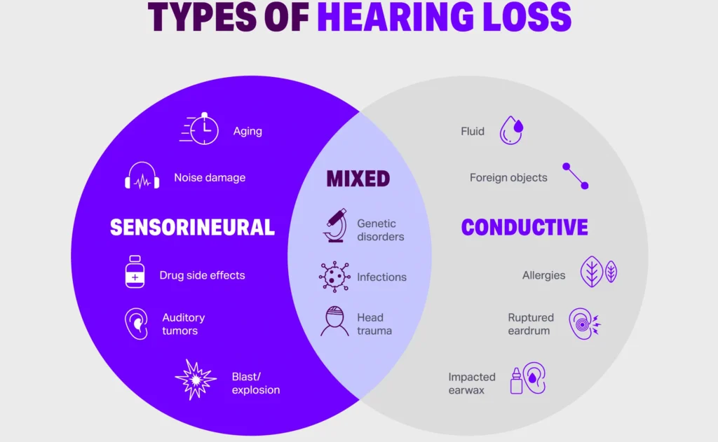 Types Of Hearing Loss E1732603950688