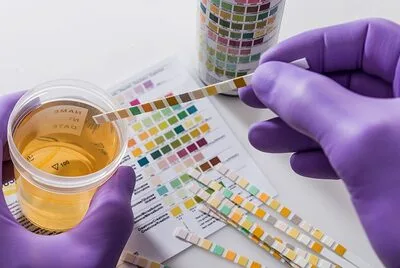 URINE TESTING 1
