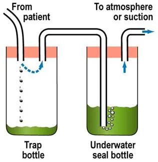 Under Water Seal Drainage 2 Bottles