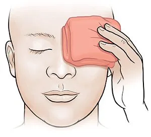 WARM EYE COMPRESS