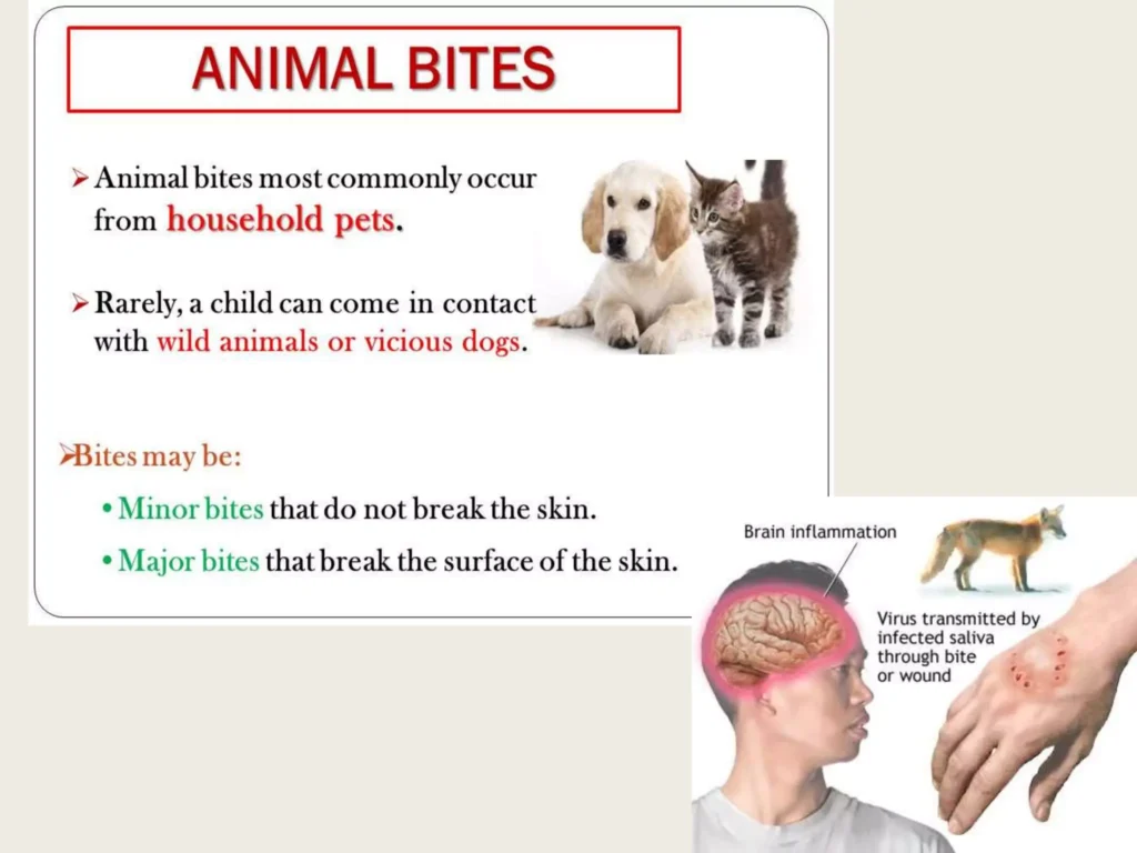 Animal Bites