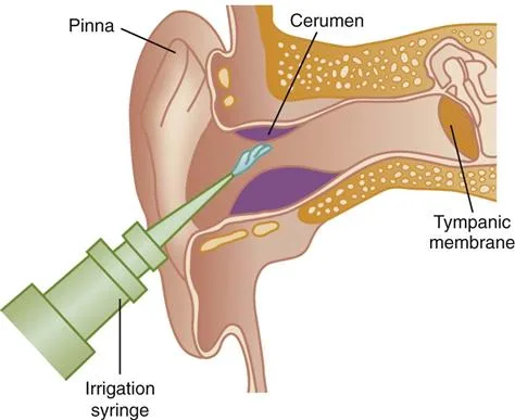 Care Of Patientd Ears Nursing